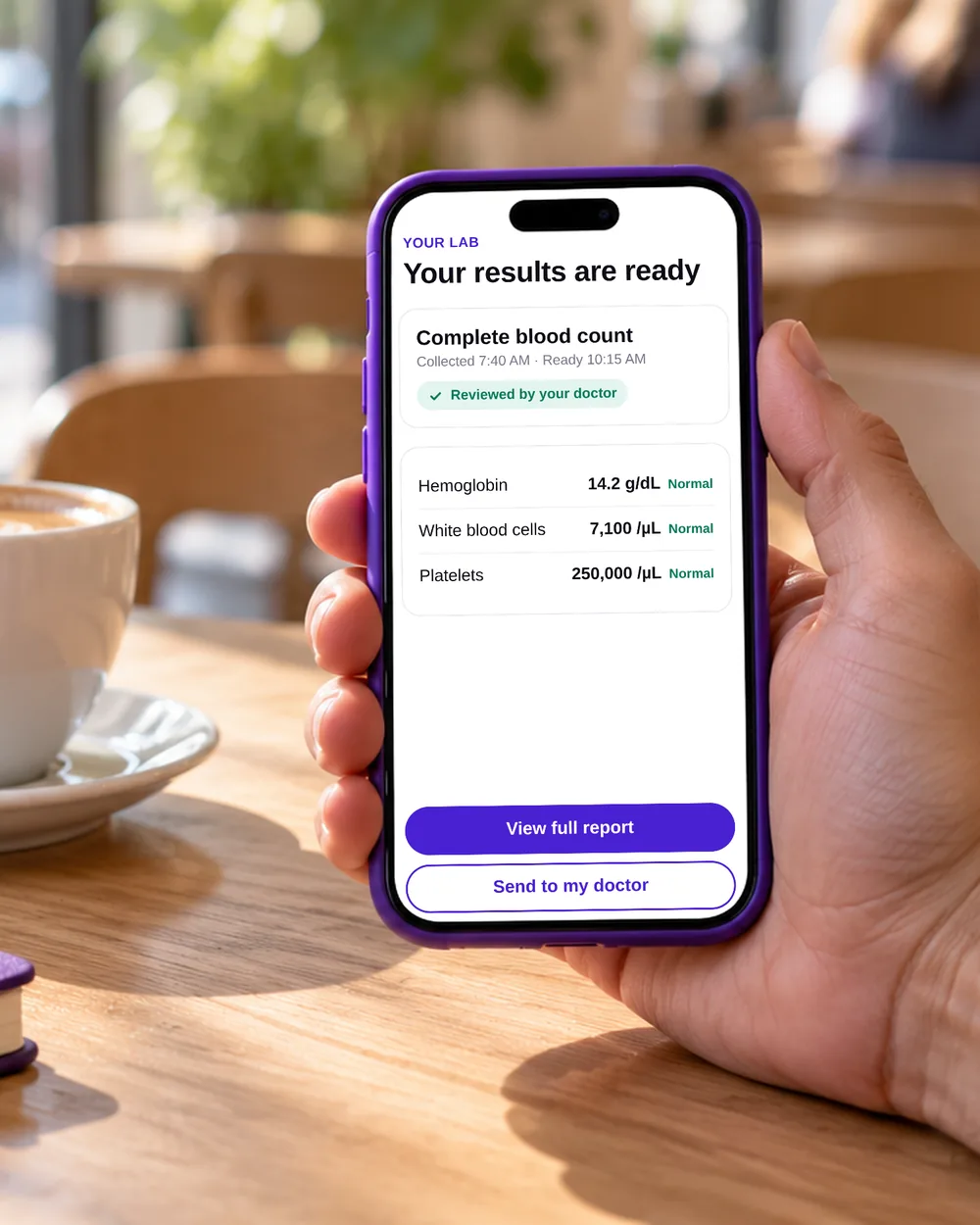 Phone showing complete blood count results, ready and reviewed by the doctor